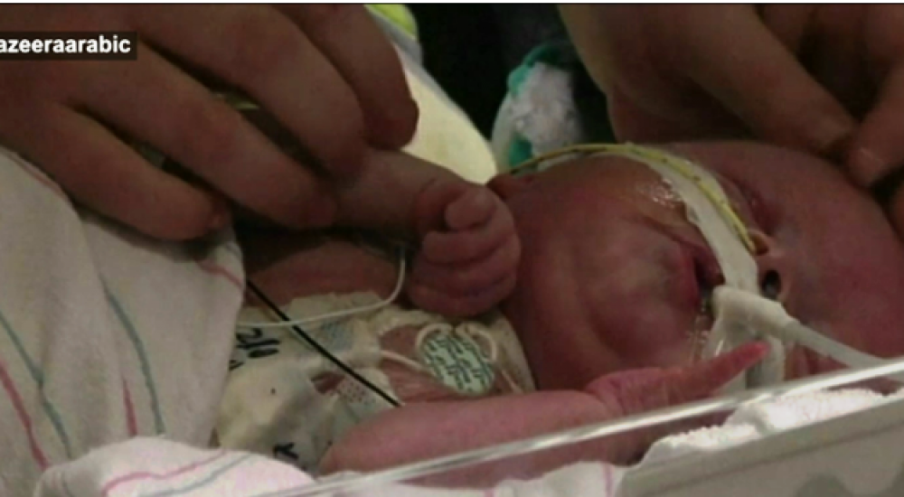 عملية نادرة لزرع قلب لرضيع أميركي