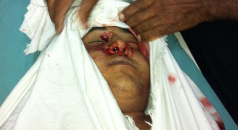 الشهيد المصري