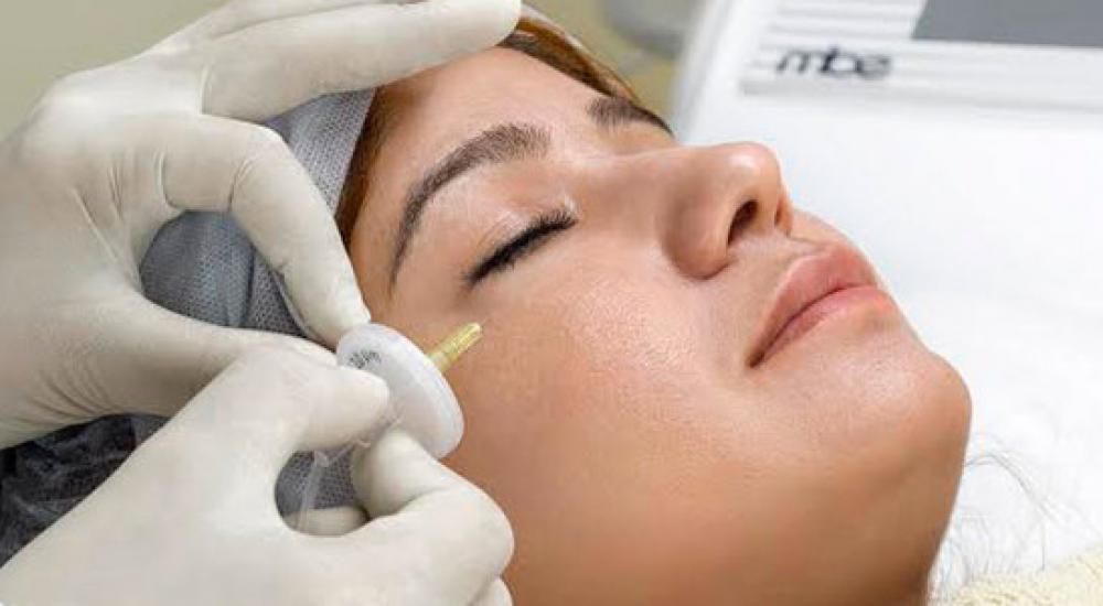 الهالات السوداء تحت العينين من أكثر الأمور إزعاجًا 