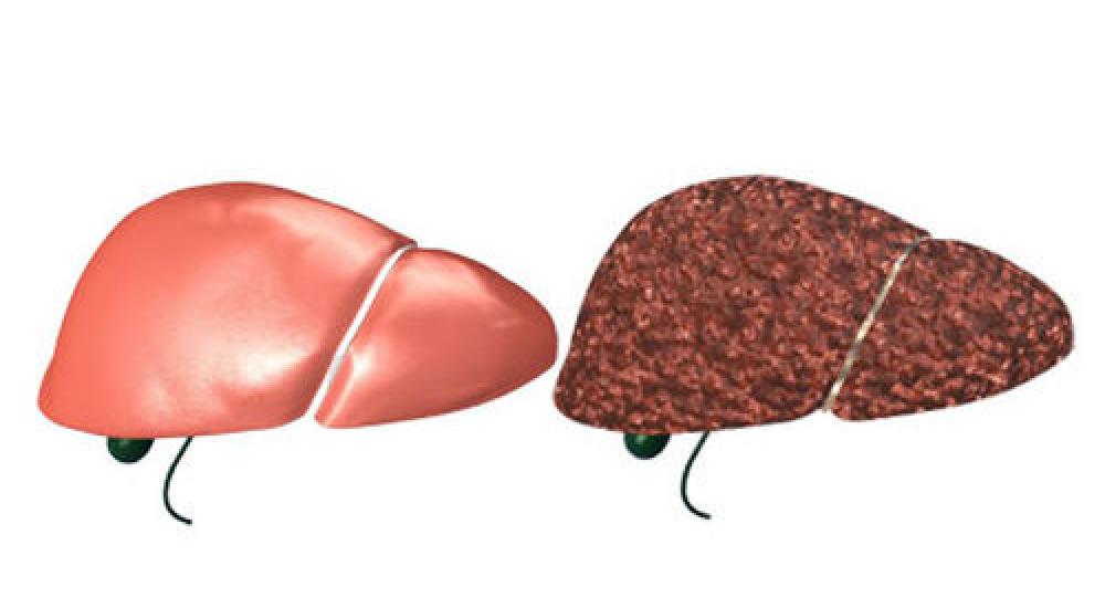  أفضل طرق العلاج   أمراض الكبد والجهاز الهضمي