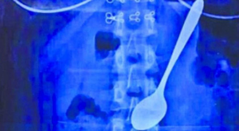 55883c83c46188c65c8b45e9