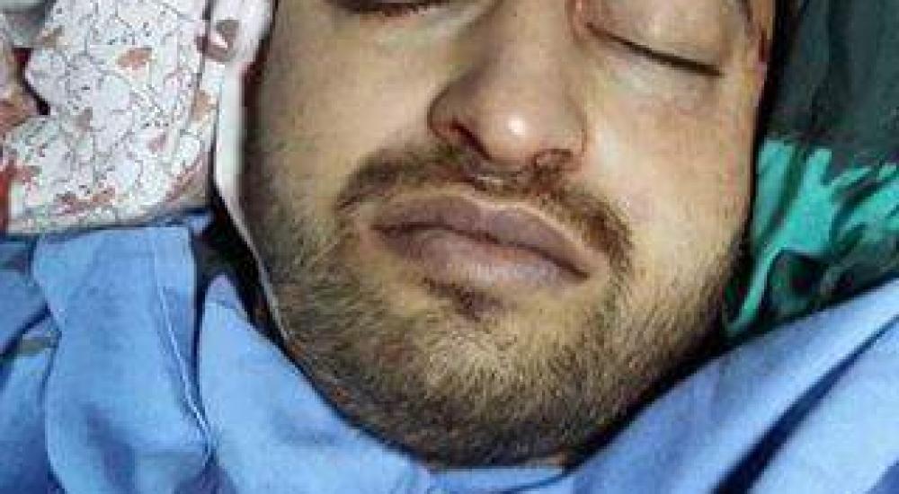 الشهيد عبد الله عزام الشلالدة 