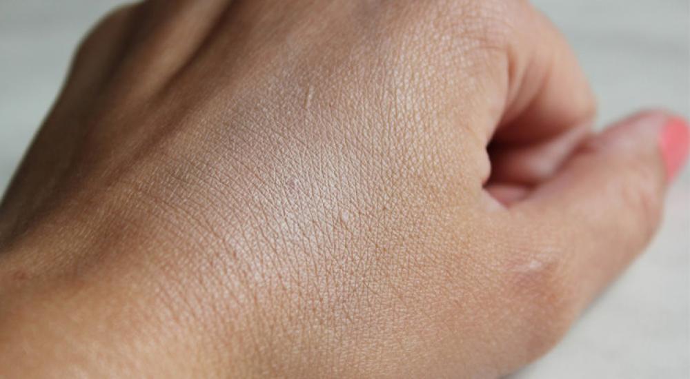 جلد الإنسان