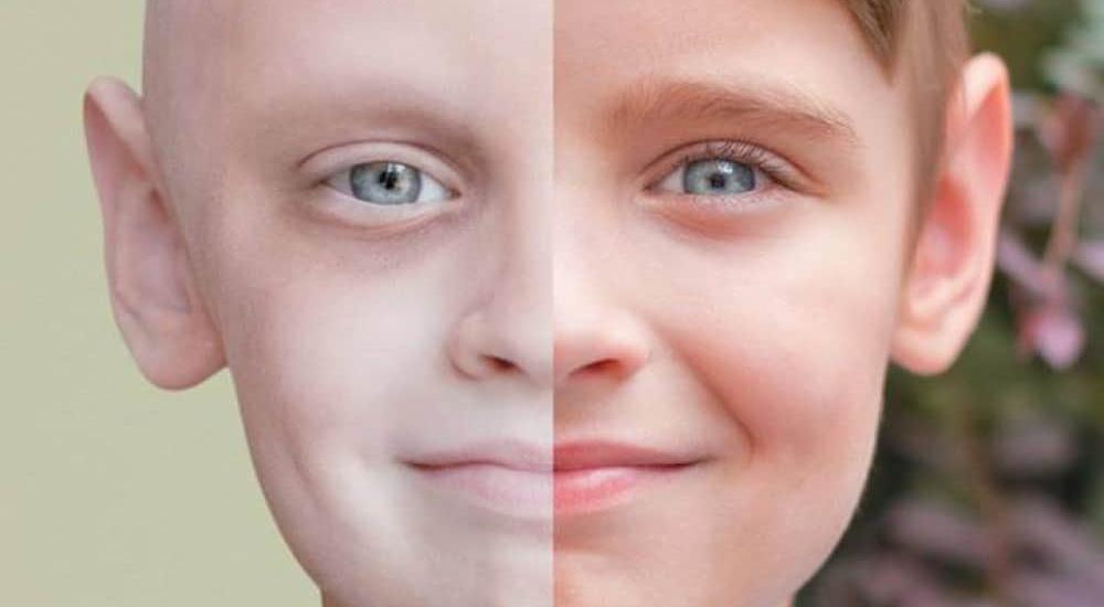 قصص-مرضى-السرطان