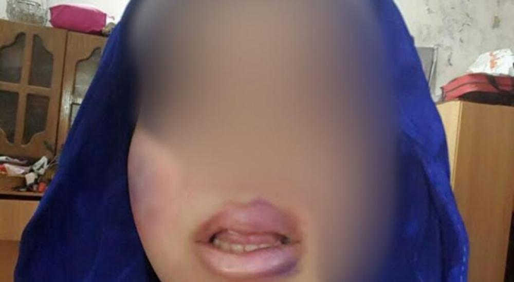 الفتاة المعتدى عليها
