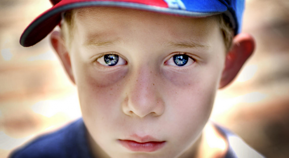 دلائل ومؤشرات تدل على حالتك الصحية من وجهك