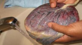  مصطلح المشيمة أصله كلمة لاتينية معناها "كعكة مسطحة"