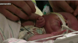 عملية نادرة لزرع قلب لرضيع أميركي