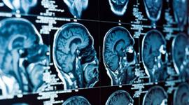 557e60fbc46188a0638b45ad