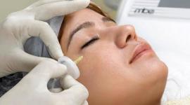 الهالات السوداء تحت العينين من أكثر الأمور إزعاجًا 