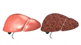  أفضل طرق العلاج   أمراض الكبد والجهاز الهضمي