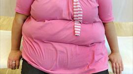 البدانة تعزز الوذمة اللمفاوية بعد علاج سرطان الثدي