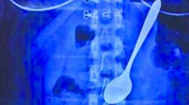 55883c83c46188c65c8b45e9