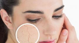  تغيير في طبقات الجلد يحصل عند الفتيات بعد أن يصلن سن البلوغ