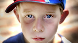 دلائل ومؤشرات تدل على حالتك الصحية من وجهك