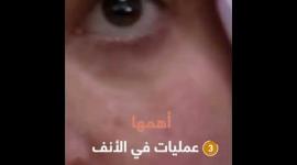 الأسيرة الجريحة "إسراء جعابيص".. 7 سنوات من القتل البطئ