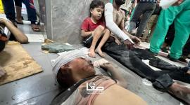 توافد عشرات الإصابات إلى مستشفى الشفاء بفعل قصف منازل المواطنين