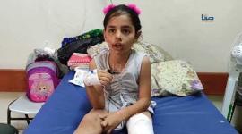 الطفلة ليان أبو صفية من غزة تناشد لإجراء عملية "ترقيع جلد" بعد إصابتها بجراح عميقة في قصف إسرائيلي