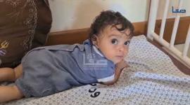تفاقم أزمة المجاعة وسوء التغذية التي تهدد حياة مئات الأطفال في شمالي قطاع غزة