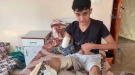 محمد درويش بترت يده بمجزرة للاحتلال في مدرسة بمخيم النصيرات ويناشد لعلاجه في الخارج للحفاظ على قدمه