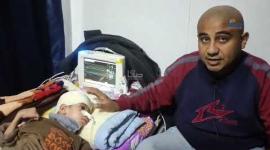 هدى الهسي.. طفلة غائبة عن الوعي ترقد في مستشفى المعمداني جراء إصابتها بقصف إسرائيلي على غزة