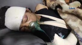 نزيف وكسور في الجمجمة.. لمى علوش أُصيبت جرّاء قصف طائرات الاحتلال منزلها شمالي مدينة غزة