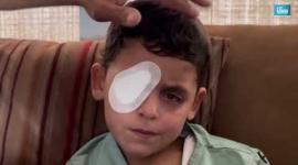 محمد حجازي.. طفل من غزة أطفأت قنابل الاحتلال نور عينيه