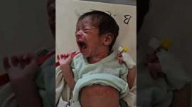 الرضيع جبر أبو قليق يبلغ من العمر أسبوعا واحدا يعاني من سوء تغذية وطفح جلدي