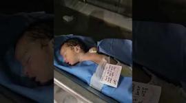 استشهاد الطفلة سعاد الشاعر (قشطة) التي ارتقت إثر مجزرة المواصي غربي مدينة خان يونس