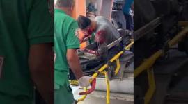 عشرات المصابين جراء استهداف قوات الاحتلال منتظري المساعدات في منطقة السودانية شمال غربي قطاع غزة