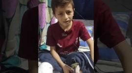 الطفل أحمد أبو وردة فقد قدمه واستشهد والده جرّاء قصف طائرات الاحتلال منزلًا في جباليا البلد شمال غزة