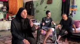 عبد الكريم أبو عمشة 15عامًا فقد ثلاثة من أطرافه بقصف إسرائيلي طال مدرسة للنازحين بغزة وحرمه من طموحه