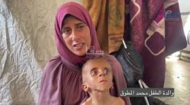 والده شهـ.ـيد.. الرضيع محمد المطوق يعاني من سوء التغذية الحاد بسبب المجاعة في غزة