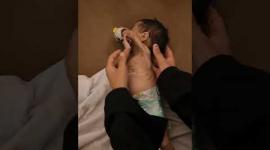 الرضيعة راسيل أبو مسعود تعاني من سوء تغذية حاد وترقد بوضع صحي صعب في مستشفى جنوبي قطاع غزة