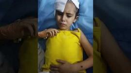 نور اشتيوي أُصيبت بكسر في الجمجمة وشظايا بالدماغ جرّاء قصفٍ إسرائيلي على منزلهم في غزة