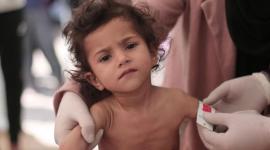 رابط التسجيل في برنامج سوء التغذية غزة.. مجلس كنائس الشرق الاوسط