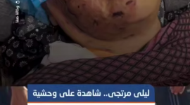 ليلى مرتجى في حالة حرجة.. ابنتها تناشد نقلها للعلاج خارج غزة
