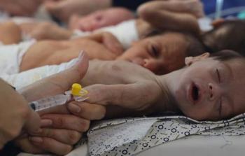 الإعلام الحكومي: أكثر من 3.500 طفل معرضون لخطر الموت التدريجي بغزة