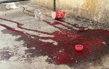 إصابات برصاص الاحتلال خلال اقتحام البلدة القديمة بنابلس