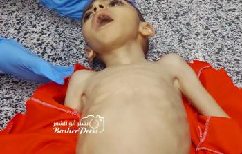 الطفل محمد مصطفى ياسين