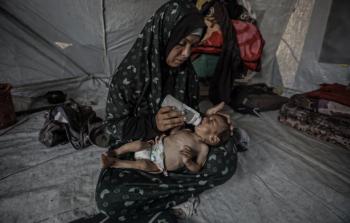 أطباء بلا حدود: أطفال غزة لا يأكلون بما يكفي