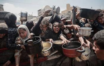 الصحة: 3 حالات وفاة نتيجة سوء التغذية بغزة خلال 24 ساعة