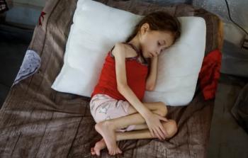 مقرر أممي: تجويع 