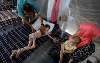 أبو سلمية: 55 ألف حامل تعاني سوء التغذية في غزة