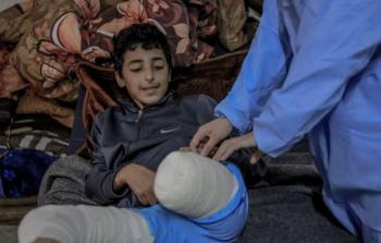 مستشفى حمد: الحرب على غزة ضاعفت حالات بتر الأطراف