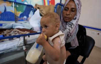 صندوق أممي: المجاعة تقتل السكان في قطاع غزة