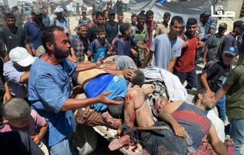 الصحة: 72 شهيدًا و356 مصابًا في غزة خلال 24 ساعة