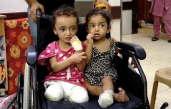 الصحة: 6000 حالة بتر في غزة تحتاج إلى برامج تأهيل عاجلة