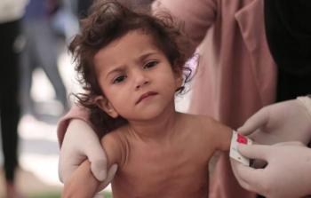 رابط التسجيل في برنامج سوء التغذية غزة.. مجلس كنائس الشرق الاوسط