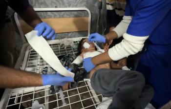 إصابة طفلين بانفجار ذخيرة من مخلفات الاحتلال بحي التفاح